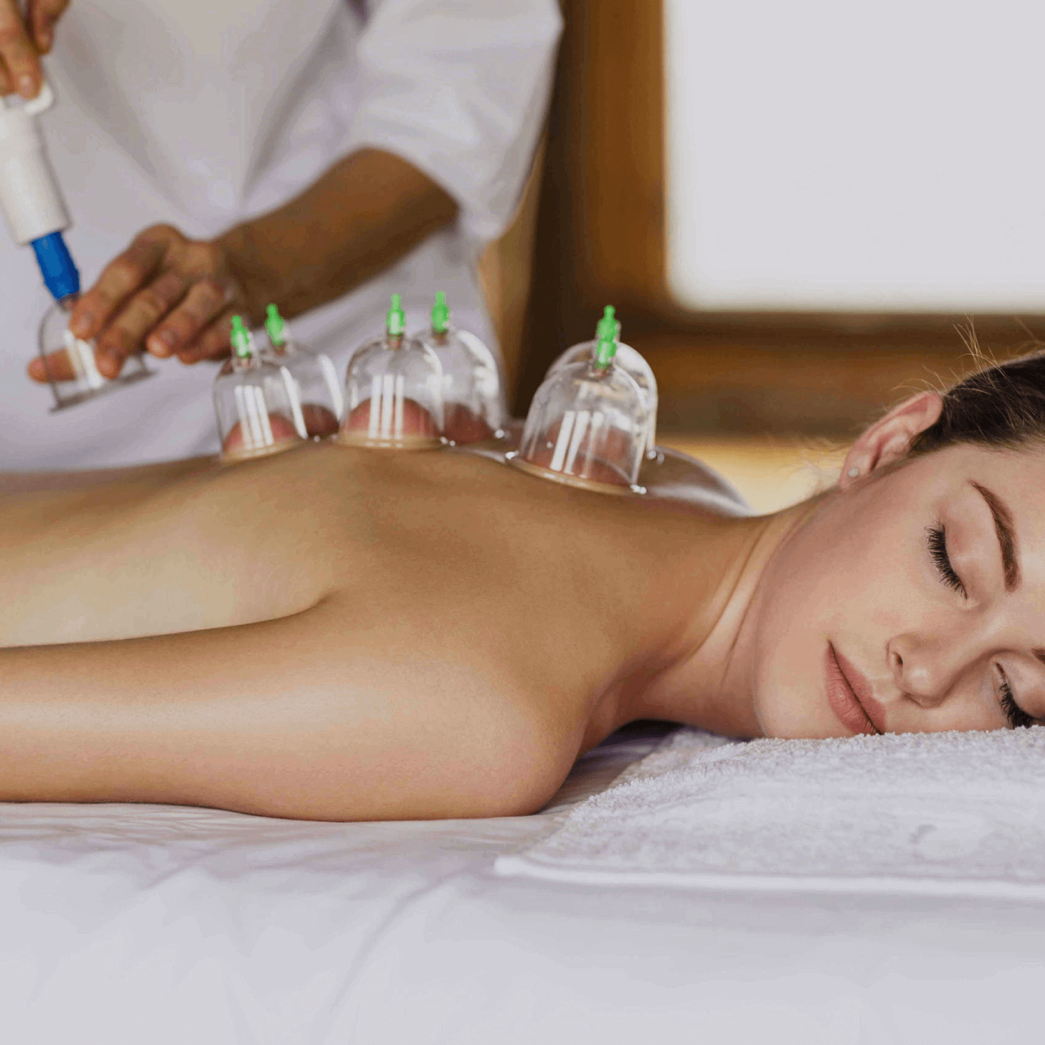 Hijama (Bloodletting cupping therapy)